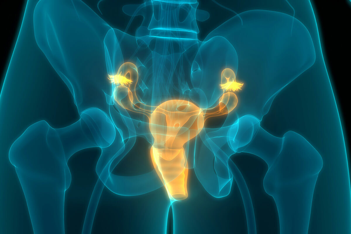 hypertonic-pelvic-floor